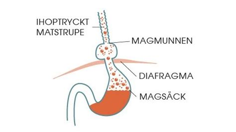 Problem med magmunnen symptom
